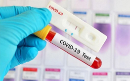 Тесты и анализы на коронавирус