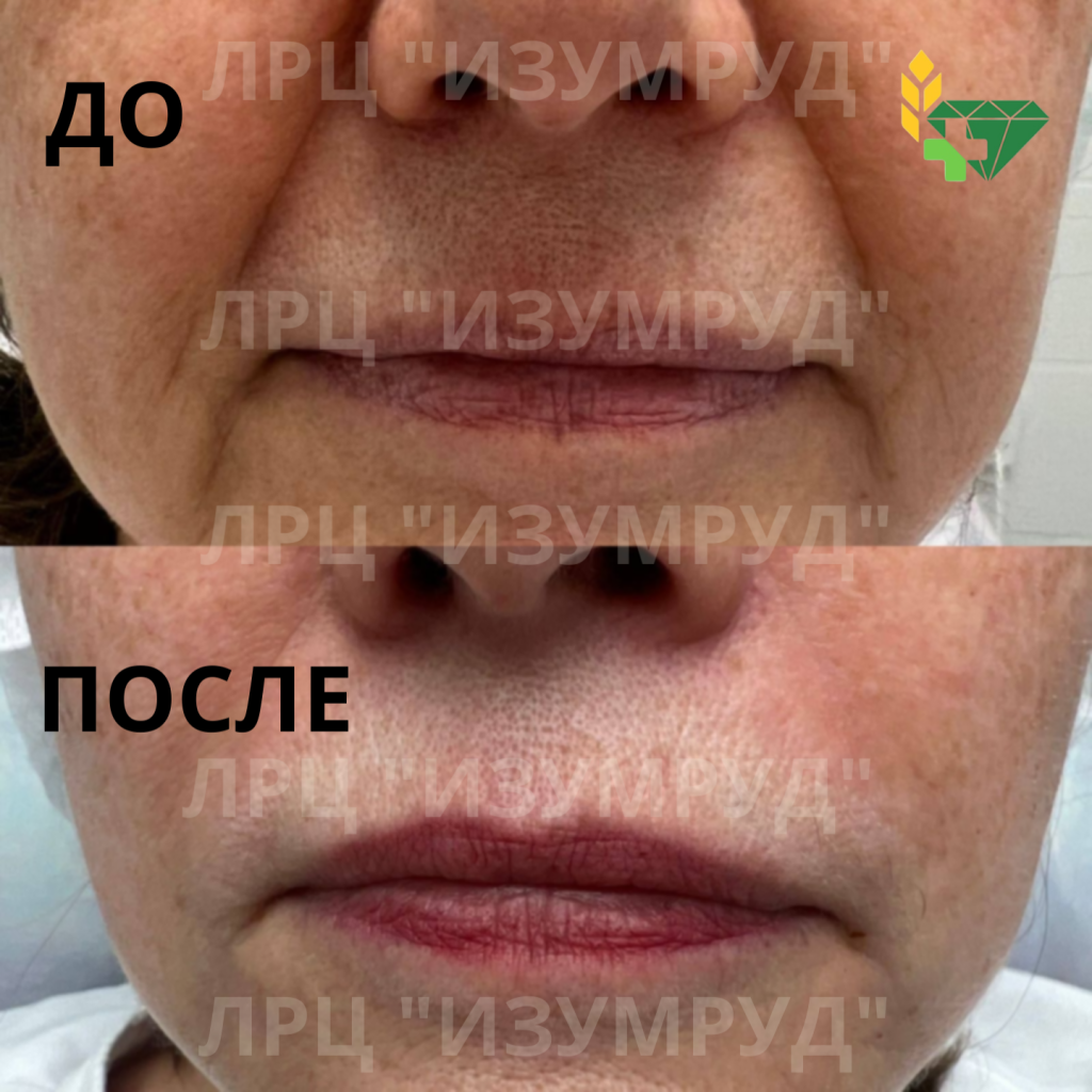 Копия Копия Копия до (2).png